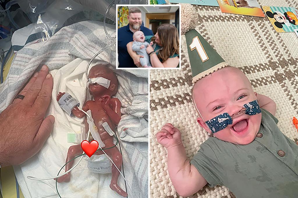 nypost's tweet image. World’s most premature baby defies all medical odds to reach 1st birthday trib.al/M81Sg9C