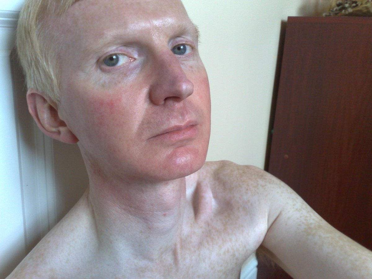I guess many of you in the UK / EU are as frustrated as I am with the loss of content and that there doesn't seem to be a way to verify age as yet. 😖
I clearly look over 18! 😉
At the age of 62 it'd be a miracle if I didn't! 🤣
I'll stick around and hope things get sorted! 🤞🥰