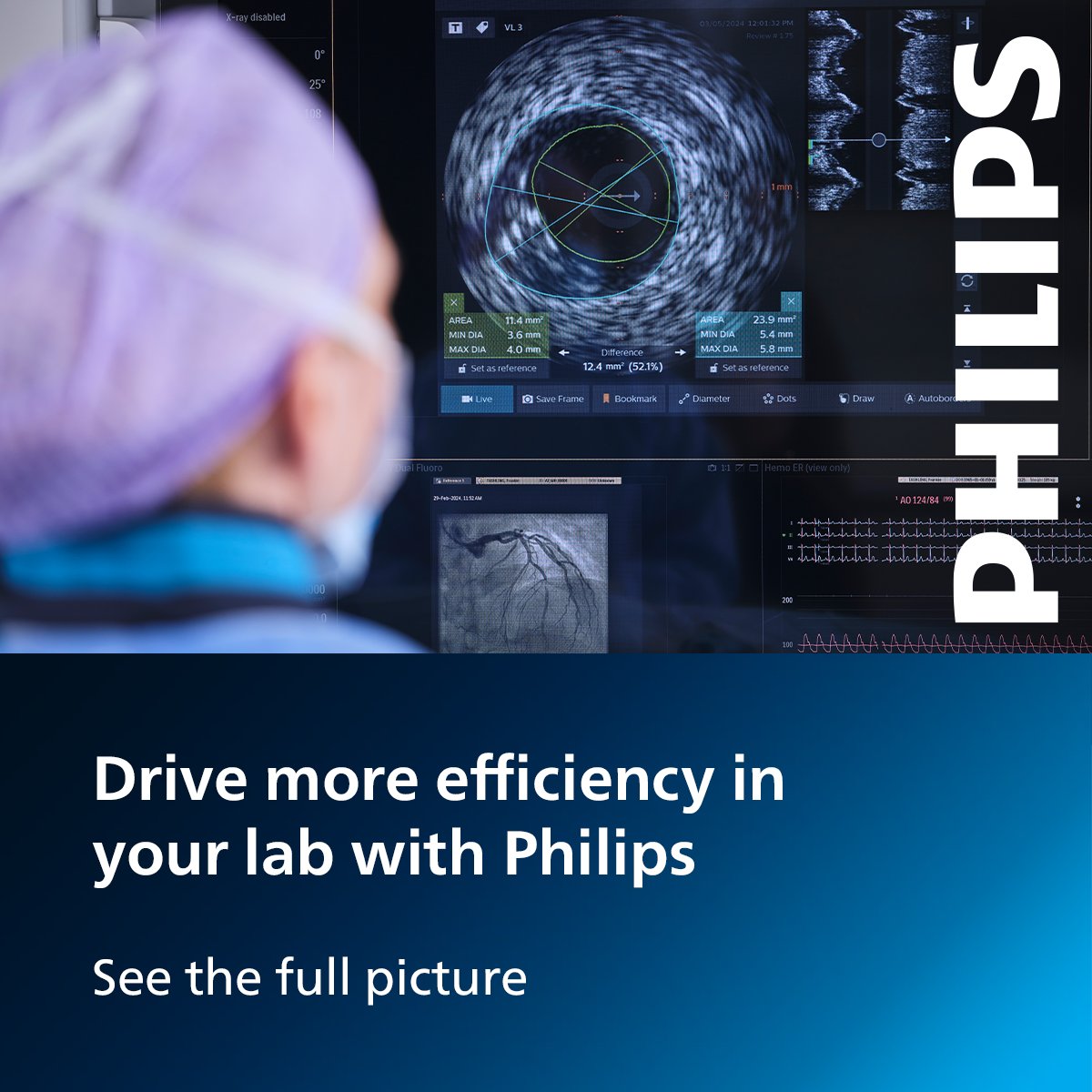 Our suite of Dynamic Coronary Roadmap, iFR, IVUS, Co-registration, and Therapy tools provide visibility for informed contemporary treatment strategies. Learn more: usa.philips.com/healthcare/clp…