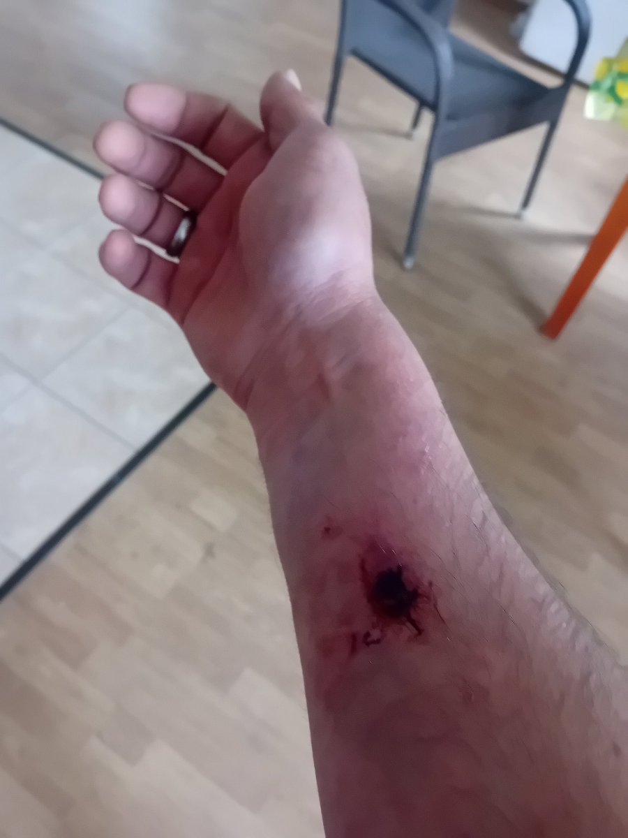 Пренеприятнейшее известие. Очень. 
Даже пиздец как очень.
Машина теперь - груда металлолома.
Пережил лобовое столкновение. Морда - в морду. Скорость не высокая, помню на 50.
Все живы. Я немного повреждён. В отличие от машин.