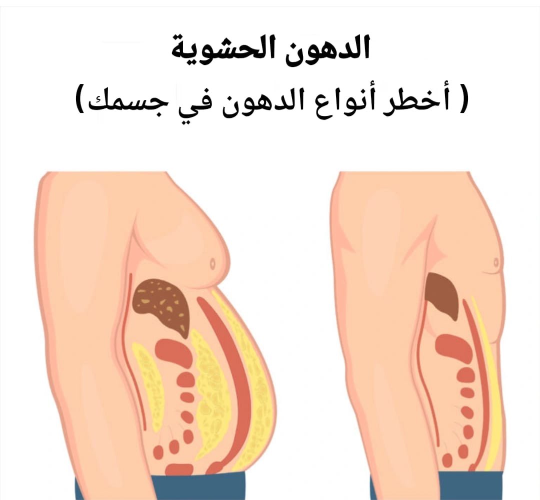 1_saad's tweet photo. 🚨🚨 الدهون الحشوية هي أخطر أنواع الدهون في جسمك.

فهي تلتف حول أعضائك ، تبطئ عملية التمثيل الغذائي ، وتغذي الأمراض بصمت..!

إليك 9 عادات مدعومة علميًا لتقليلها بشكل طبيعي : 🧵 https://t.co/3hECZpvgec