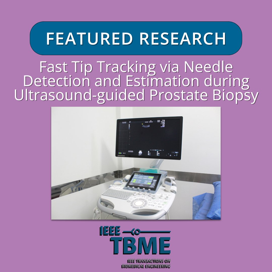 IEEEembs's tweet image. New from IEEE TBME: Fast Tip Tracking for Ultrasound‑Guided Prostate Biopsy
Researchers have unveiled a lightweight Needle Detection & Estimation framework to help with image quality & needle visibility in ultrasounds.
🔗 Read more: bit.ly/401EShT