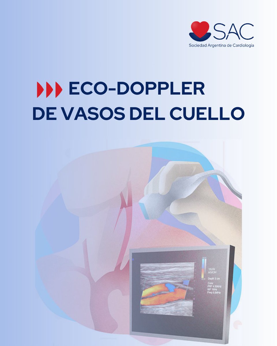 SAC_54's tweet image. 🔵Curso de Eco-Doppler de Vasos del Cuello 📣 ¡Abierta la inscripción! 

🔺Actualizar y profundizar el conocimiento teórico y técnico sobre la exploración con Eco-Doppler de los vasos del cuello.

📌Inicio:  4 de agosto  

¡No te quedes afuera!

✅Más información 👉🔗…