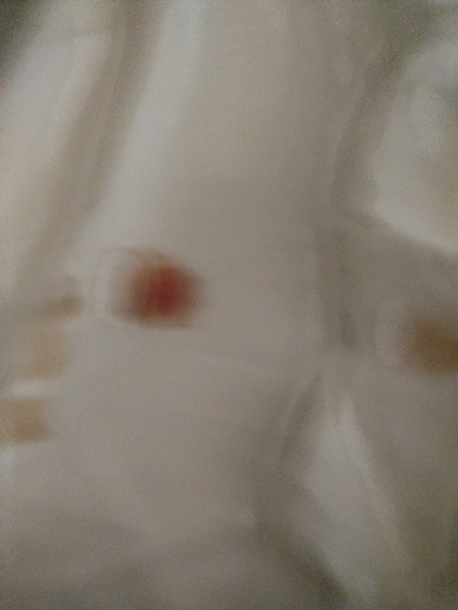 NAVYOFWAVES's tweet image. Blood ? /
I&apos;m so sorry but there&apos;s something going on with my cat. The Power was out so these were the best pictures I could take. PLEASE let me know what this could be. My mom doesn&apos;t know if we should take her to a vet, i think we should