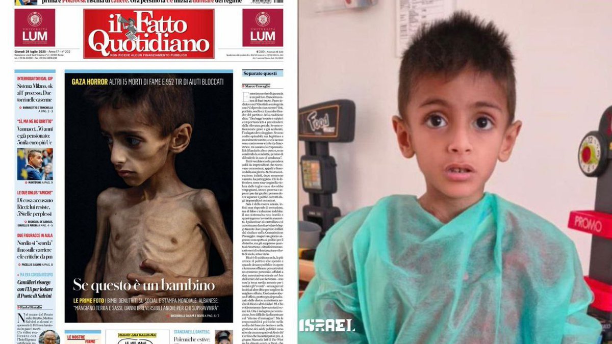 Defensa_Israel's tweet image. La implacable maquinaria de propaganda a todo vapor!
🏴
- El de la imagen es Osama al-Raqab, quien sufre de fibrosis quística, una seria enfermedad genética.
- #Israel lo envió a #Italia desde Gaza para que sea tratado allí, pero los medios y las redes en Occidente venden su…