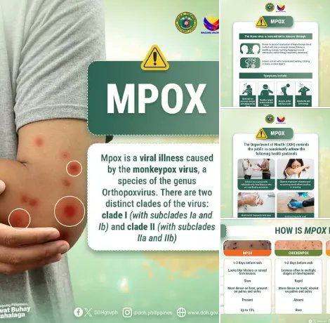 bactiman63's tweet image. #Philippines: 1st #mpox case reported in #SurigaodelSur    #Caraga open.substack.com/pub/outbreakne…
