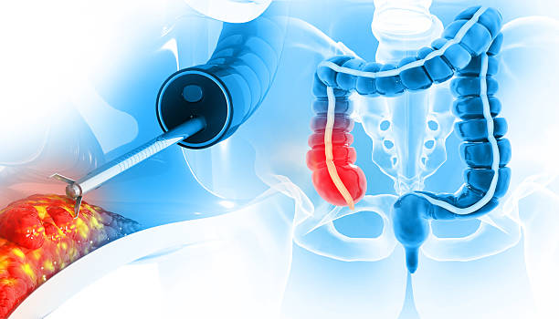 BCMCME's tweet image. 🚨 You won’t want to miss this.
@NMansourMD's talk, "Computer-Aided-Detection Assisted Colonoscopy – Applying the AGA guidance."
Access the full video in our course here: bit.ly/3IvXvEt
@bcm_gihep @TexasGastros