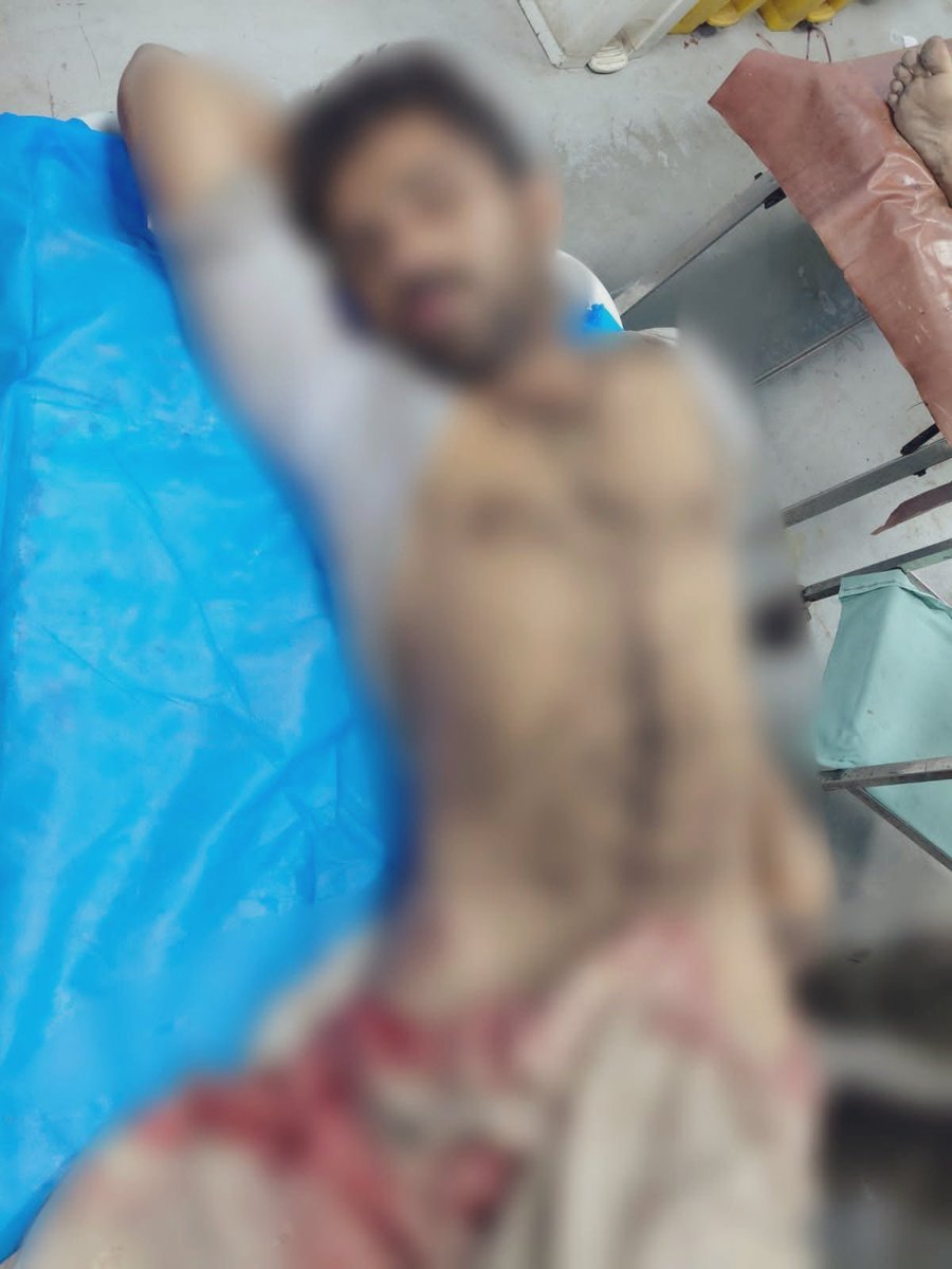 قصور میں بچی کیساتھ نازیاب حرکات کرنیوالا ملزم زخمی حالت میں گرفتار۔ پولیس کے مطابق گرفتاری  کے وقت اس نے پستول نکالنے کی کوشش کی۔ پستول سے گولی چل گئی جس سے اس کے پرائیویٹ پارٹس ناکارہ ہوگئے