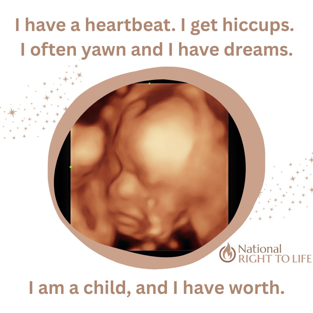 Abortion is the very real nightmare from which babies never wake up.
