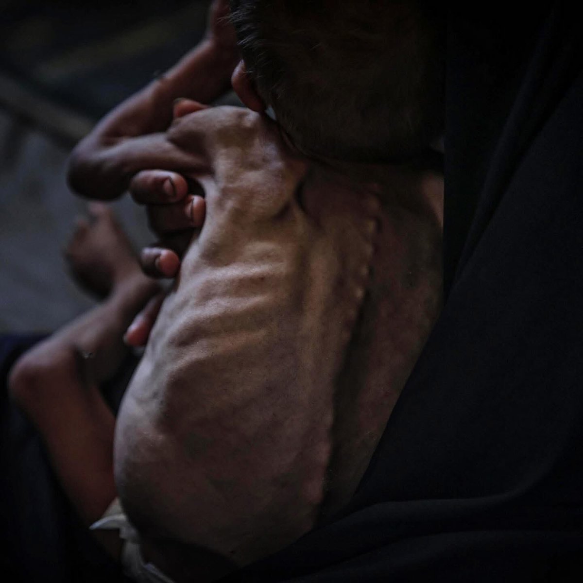 NourIsmail72942's tweet image. I feel sorry for those who have reached this stage, and then I start to feel afraid that my family and I will also reach this stage. I hope that your support will not stop so that we can buy food.
chuffed.org/project/137673…