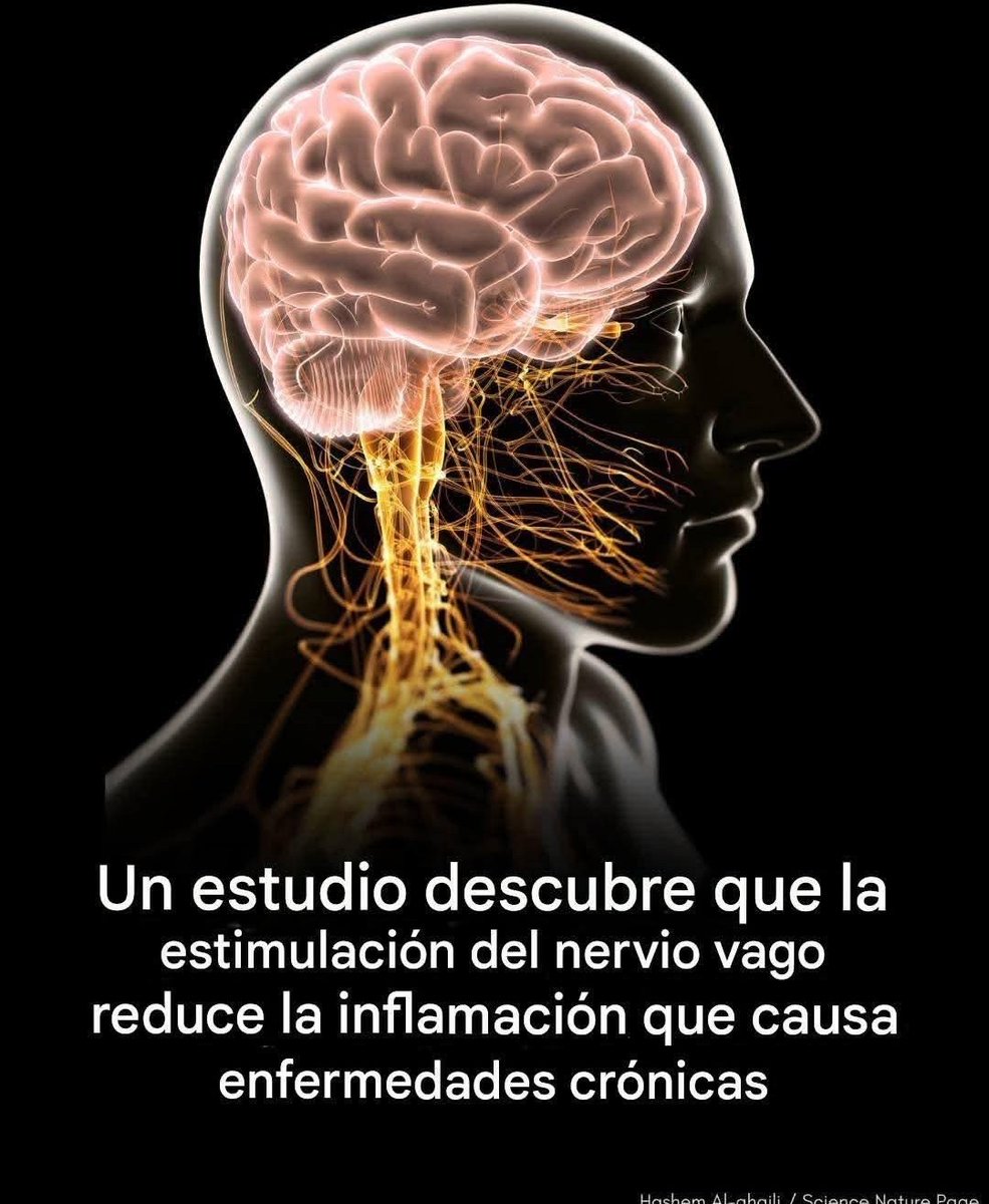 melgvox's tweet image. Necesario?