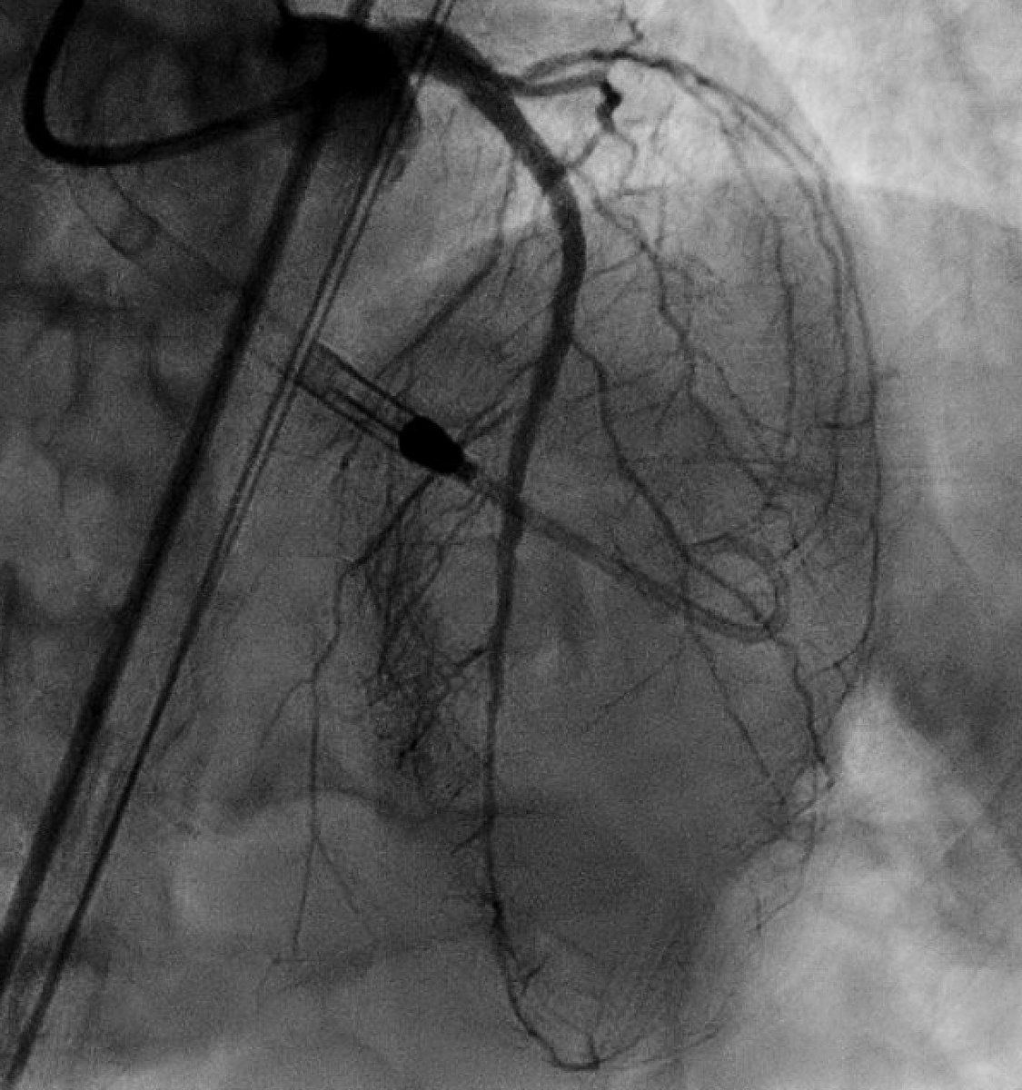 Atul D. Bali, MD tweet media