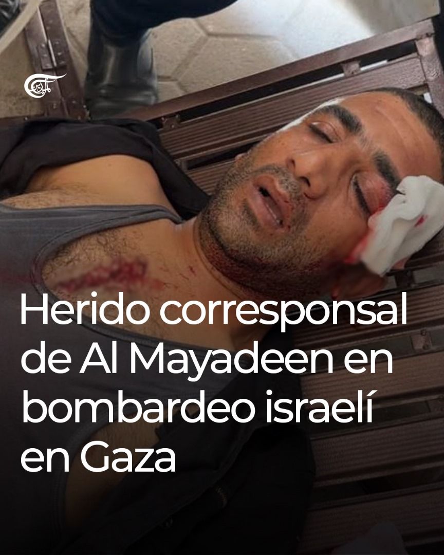 Periodista de Al Mayadeen herido en Gaza por ataques israelíes. El corresponsal Akram Dalloul resultó herido durante un bombardeo israelí en el barrio de al-Zaytoun, en la ciudad de Gaza. Sufrió una herida de esquirla en la cabeza, pero ha superado el peligro.