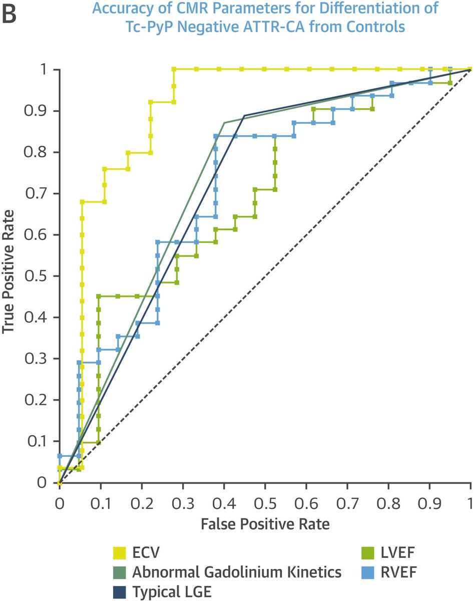 JSlivnickMD's tweet image. Proud to see our work on value of #WhyCMR in ATTR-CA with grade 0-1 Tc-PyP in @JACCJournals imaging. 💡 12% of biopsy-proven ATTR-CA have grade 0-1 PyP. Further testing needed if high suspicion.
💡ECV accurately identified ATTR-CA with grade 0-1 Tc-PyP
🔗sciencedirect.com/science/articl…