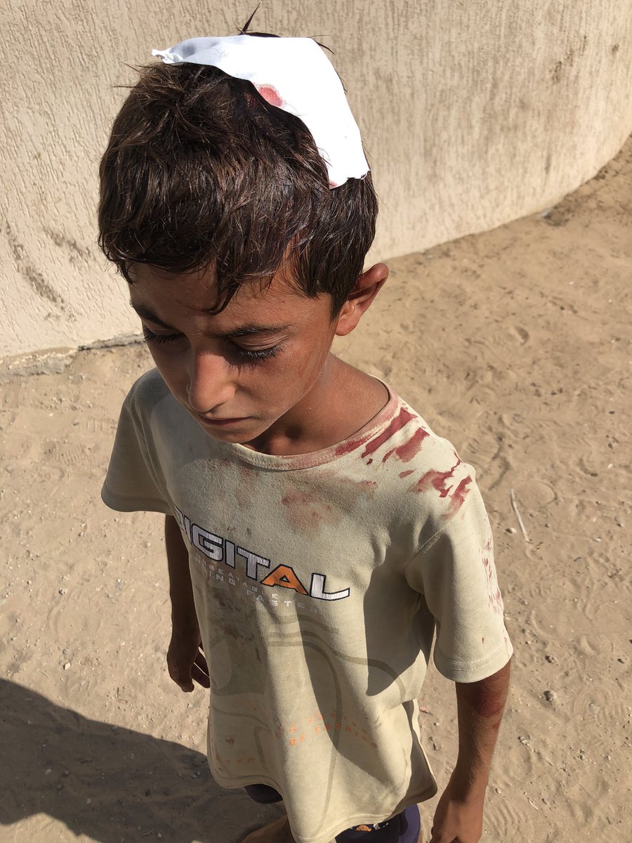 Hamood8480's tweet photo. Ahmed and his family are hungry, suffering from famine. Help Ahmed feed his family. Also help Ahmed treat his little brother Mohammed who was injured in the war.
GFM: https://t.co/wBp2otY62g https://t.co/OYbn6G9ZO6