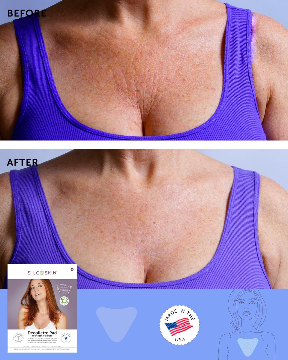 SilcSkin's tweet photo. Designed for your delicate décolletage. 💗 The SilcSkin Décollette Pad stays in place while you relax—soft, flexible, and reusable up to 30 times. Just peel, stick, and unwind. Right now take 15% of plus free shipping. Use code SUMMER15. https://t.co/31XUWIyEE8