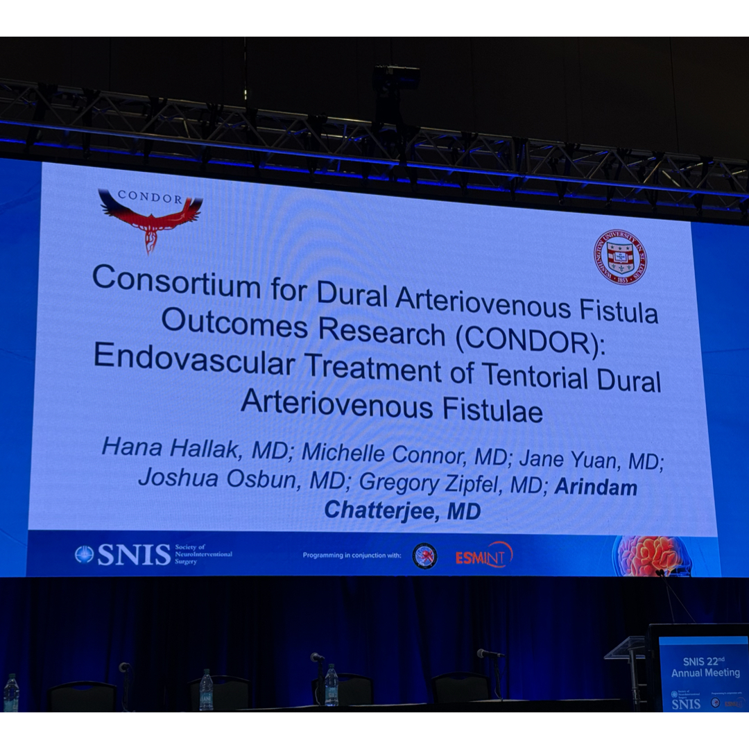 JNIS_BMJ's tweet image. Dr. Hallak presenting on tentorial DAVFs in Ballroom A #SNIS2025
@SNISinfo @esmintsociety @cvsection @fcalbuquerque51 @dr_mchen @dannidiestro @MattAmansMD @ducruetaf @MattFusco_MD @DrAltschul @cruzcerebri @niko_mou @aliyasiddiqui04