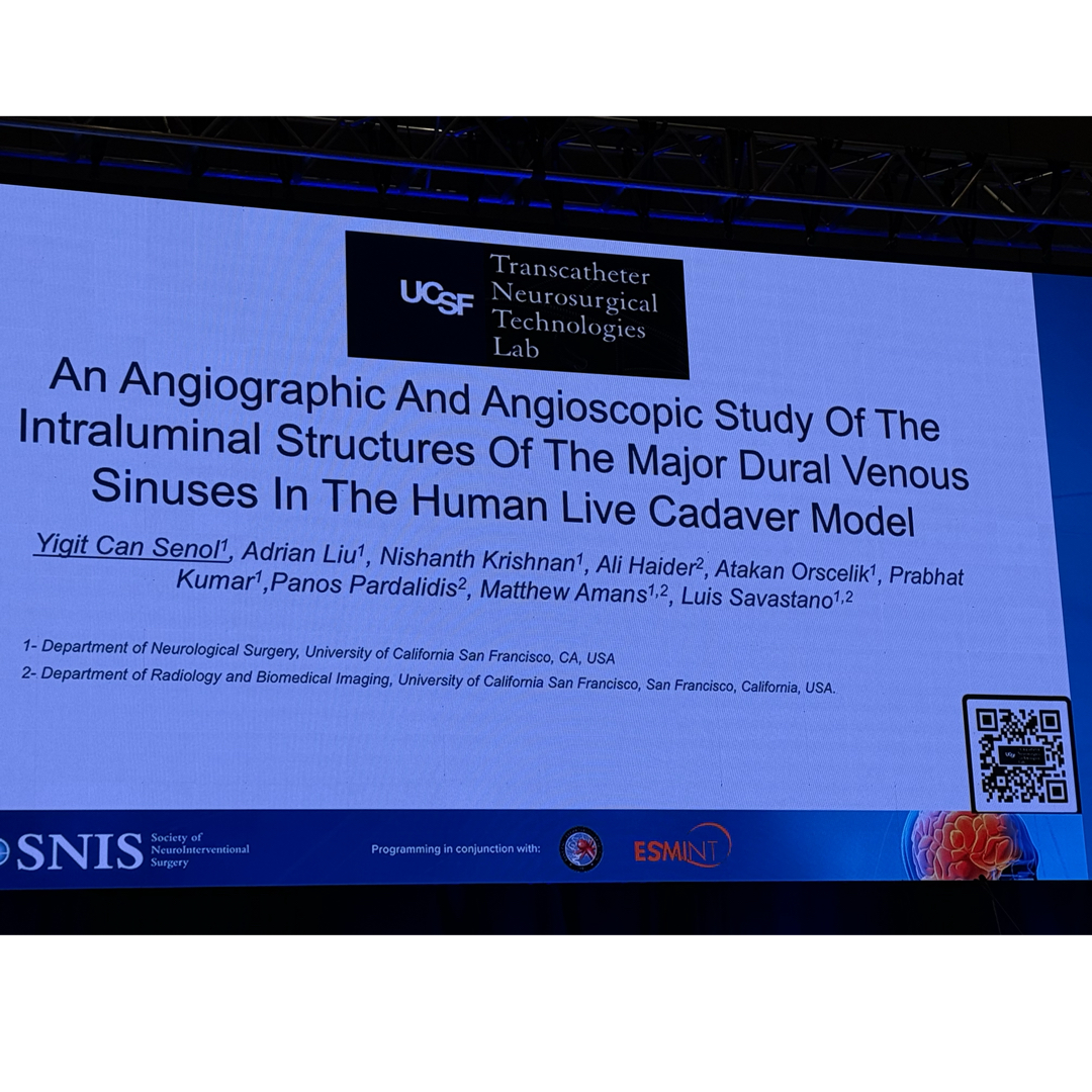 JNIS_BMJ's tweet image. Dr. Senol presenting cadaveric venous sinus research from @UCSF_NIR in Ballroom A #SNIS2025
@SNISinfo @esmintsociety @cvsection @MattAmansMD @fcalbuquerque51 @dr_mchen @dannidiestro @ducruetaf @MattFusco_MD @DrAltschul @cruzcerebri @niko_mou @aliyasiddiqui04