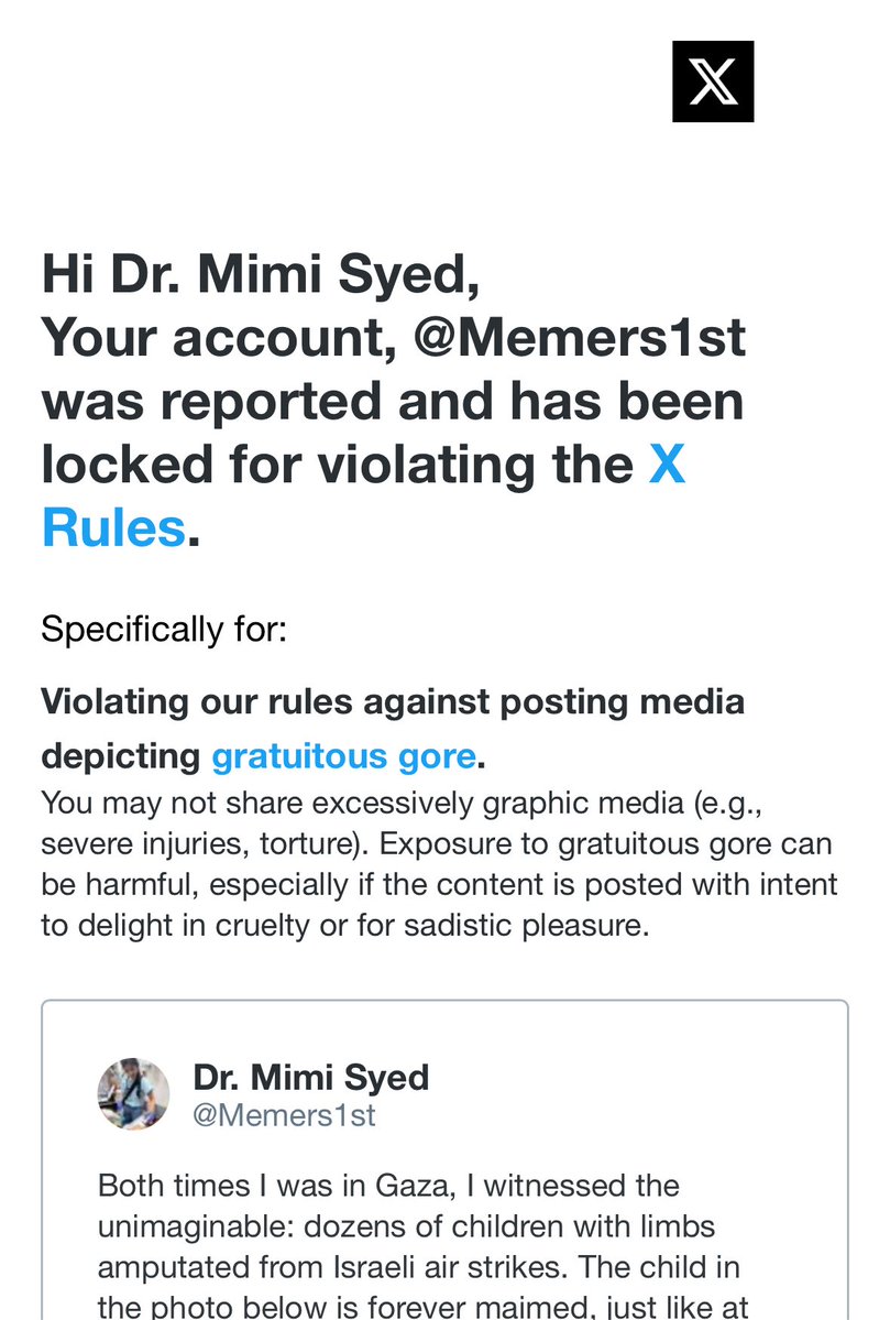 Memers1st's tweet image. The truth is hard to look at so I am banned from posting it. Meanwhile, the mothers in Gaza must continue to witness their children being shot in the head and have their limbs blown off. At least we are spared from seeing it. #warcrimes #censorship