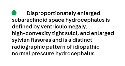 ContinuumAAN's tweet image. Key Point 3 from the article Radiographic Evaluation of Normal Pressure Hydrocephalus by Drs. Petrice Cogswell and Aaron Switzer, from the June Disorders of #CSF Dynamics issue, which is available to subscribers at hubs.la/Q03vQZk-0.
#Neurology #NeuroTwitter #MedEd