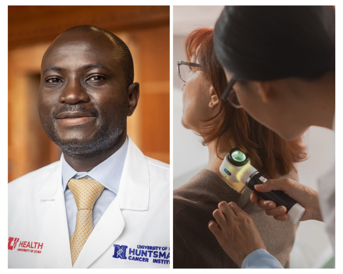 Huntsman Cancer Institute (@huntsmancancer) on Twitter photo A new review led by Dr. Elliot Asare shows older adults and rural residents face delays and worse outcomes from aggressive skin cancers. Early detection saves lives—we need to close the gap in care. Learn more: bit.ly/3IvWBYK <a href="/UofUSurgery/">UofUSurgery</a> A new review led by Dr. Elliot Asare shows older adults and rural residents face delays and worse outcomes from aggressive skin cancers. Early detection saves lives—we need to close the gap in care. Learn more: bit.ly/3IvWBYK <a href="/UofUSurgery/">UofUSurgery</a>