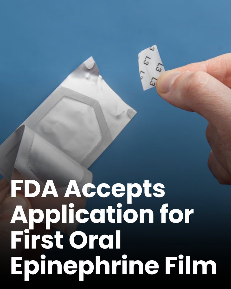 The FDA has accepted the New Drug Application for Anaphylm, a sublingual (under-the-tongue) epinephrine film being developed by Aquestive Therapeutics, Inc. for the treatment of severe allergic reactions, including anaphylaxis. A decision is expected by January 31, 2026.
Why does