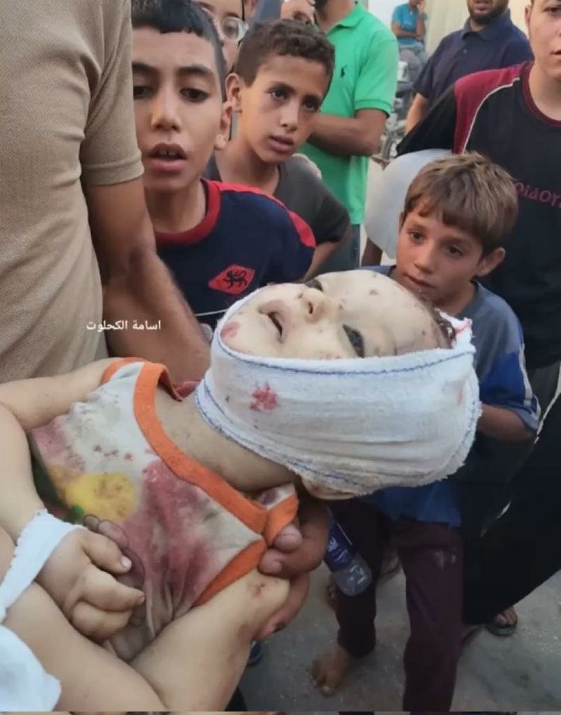 اللهمَّ اقتل من قتلهم واعان قاتلهم
#GazaGenocide 
#GazaUnderAttack 
 #غزة_تحت_القصف