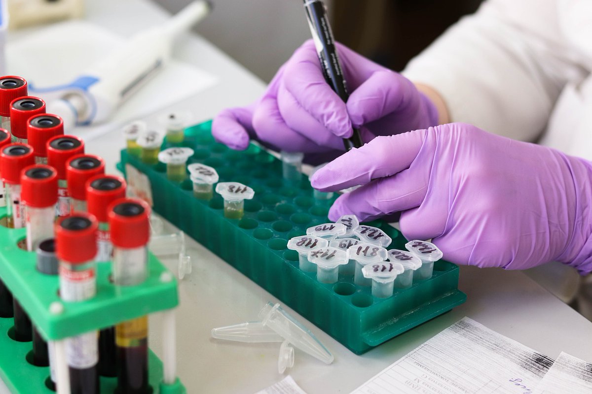 🧫 By studying ex vivo cultures of breast cancer patient-derived circulating tumor cells, investigators at <a href="/harvardmed/">Harvard Medical School</a> identified a CDKN1B-AKT1-dependent mechanism controlling entry into a drug-persistent state.

📖 <a href="/PNASNews/">PNASNews</a> | bit.ly/4lqcyya