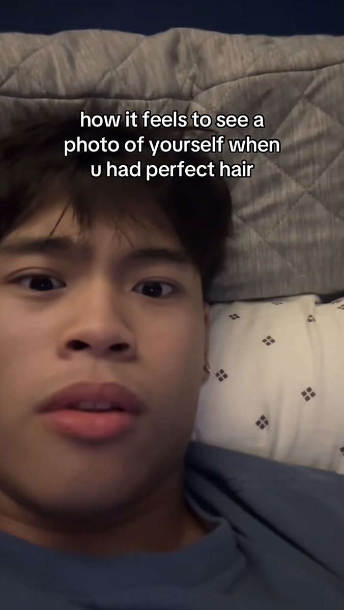 cancelling all my plans this year until my alopecia areata is treated.