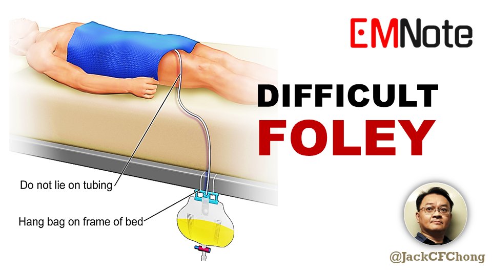 Can’t Pass a Foley？What to Do Step by Step. 
youtu.be/cBEgg1HVjQY