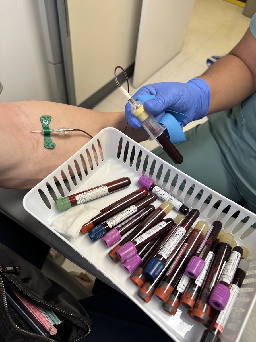 bryan_johnson's tweet image. A big blood draw today. Here's what I'm testing:
Sauna: 50 Sessions
+ Vascular markers related to angiogenesis, vascular health, and function: VEGF, MMP-9, MPO, and hs-CRP.
+ My central pulse pressure and wave measurements already show substantial improvements in vascular…