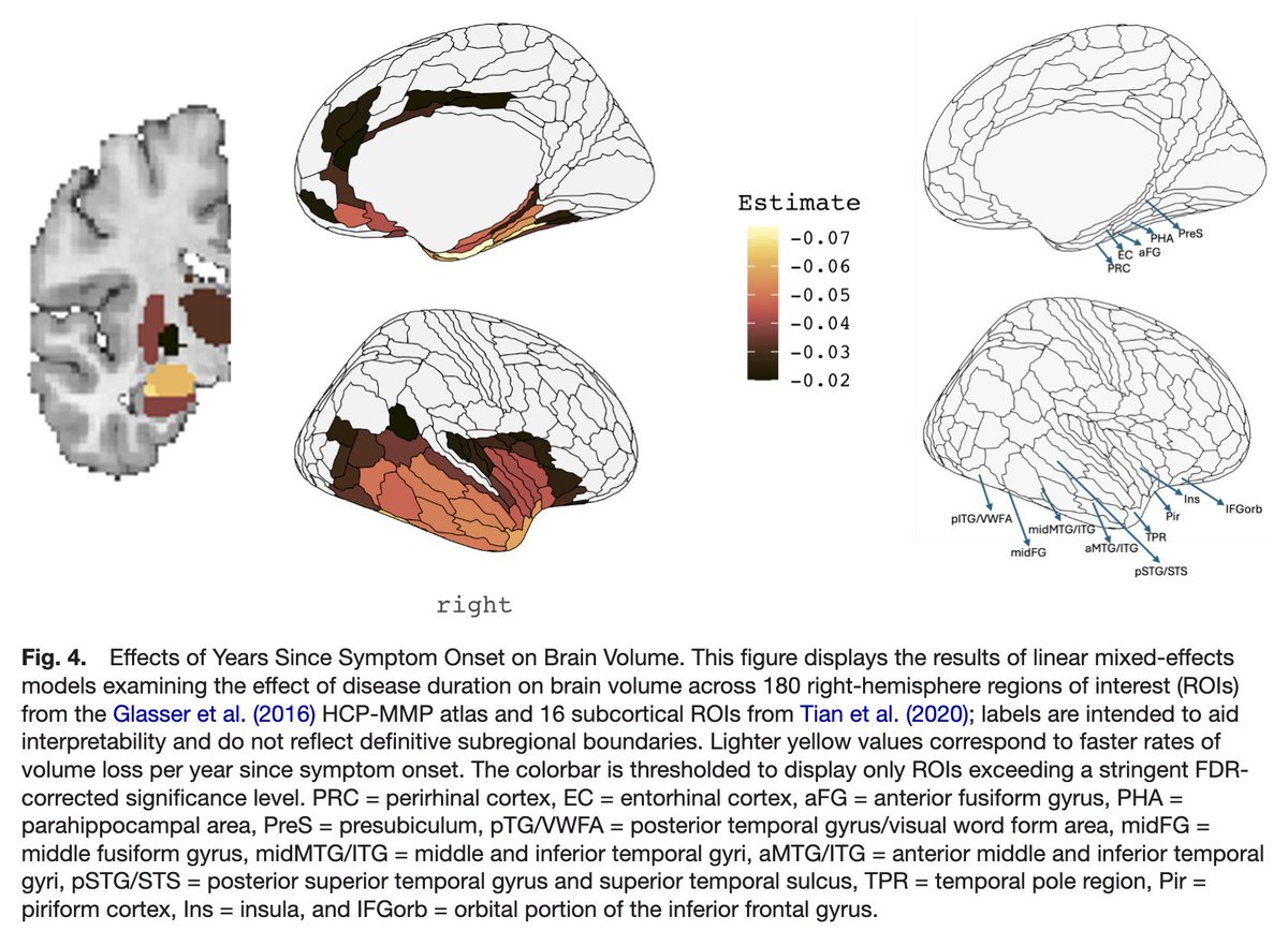ImagingNeurosci's tweet image. New paper in Imaging Neuroscience by Jane Stocks, M-Marsel Mesulam:
Spatial and temporal progression of neurodegeneration in confirmed and suspected TDP-43 type C pathology