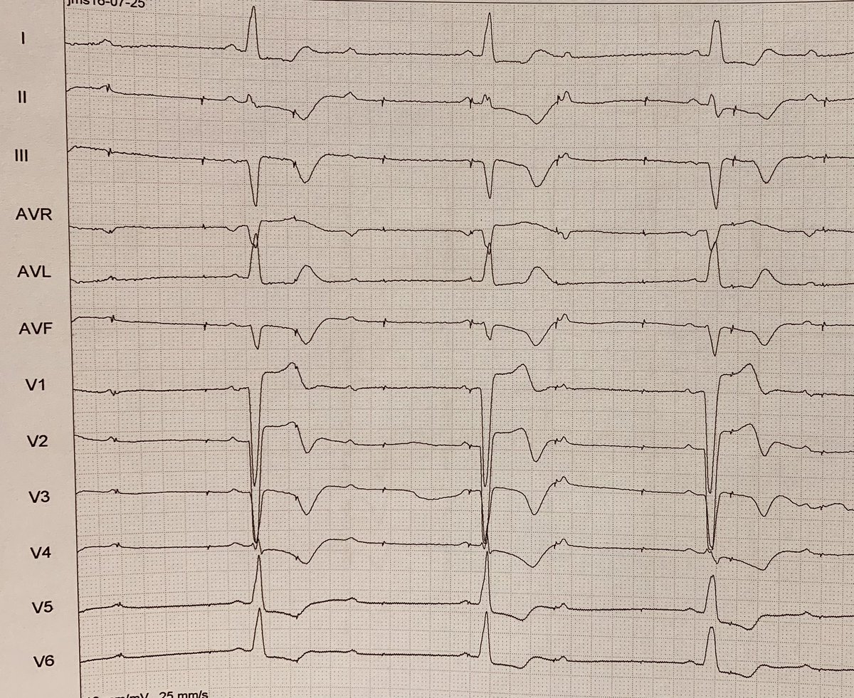 Rodrigo Isa Param tweet media