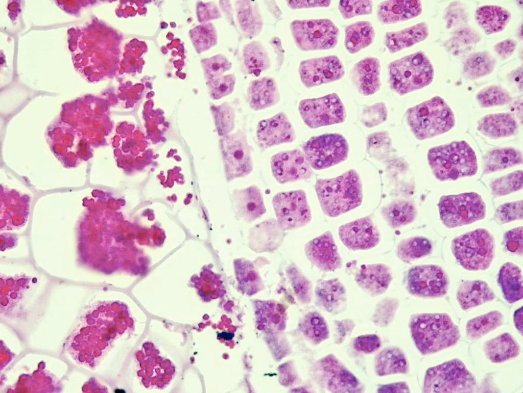 Random things in rectal biopsies.