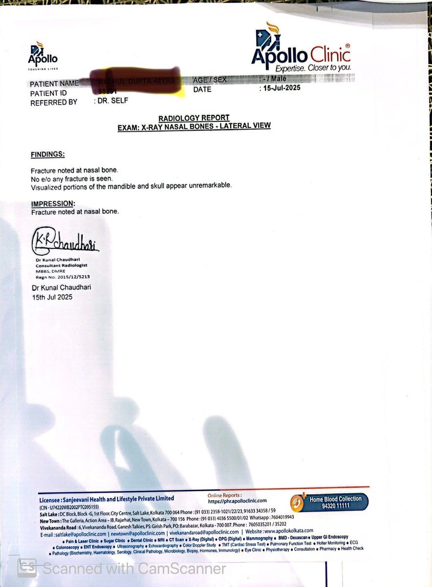 rahul_mayfair's tweet image. Gap Your store design at kolkata-CC2 lacks basic safety cues. I hit the transparent glass entrance (no sticker/warning) and suffered a nasal bone fracture. A global brand must not overlook such a fundamental safety element. Please address this immediately. #DesignResponsibly #GAP