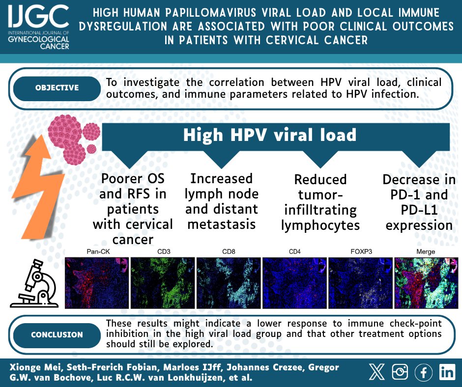 IJGConline's tweet image. 🧬 Higher #HPV Viral Load = Worse Outcomes in #CervicalCancer
New study shows that high HPV DNA levels are linked to:
📉 Lower survival
📈 More metastasis
🔻 Weaker immune response
🔍 bit.ly/4lRnTXK
@pedroramirezMD @HsuMd @JayrajAarthi @AndreFernandes2 @IGCSociety…