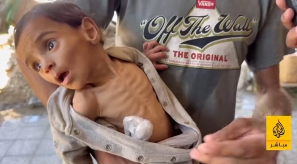 QudsNen's tweet image. Palestinian child Odai was born orphaned and is the sole survivor of his family following an Israeli massacre.
He has now been diagnosed with acute malnutrition, and medics have warned that he may die within weeks if he is not rescued and provided with baby formula and other…
