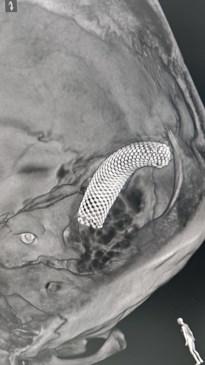 Dr Sharath Kumar G tweet media