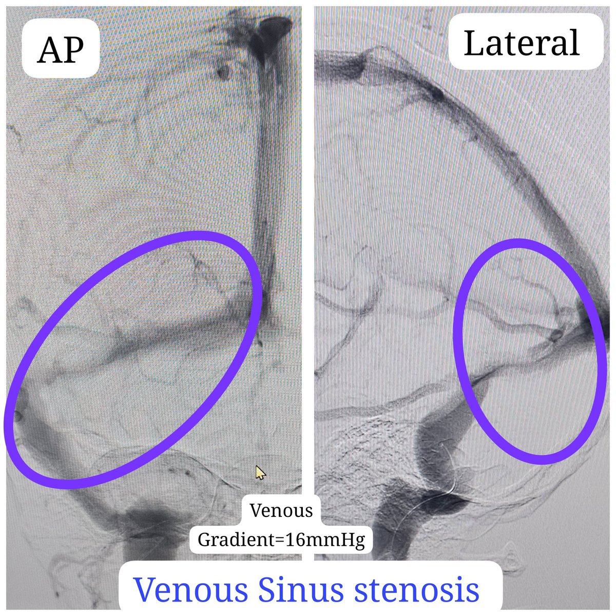 Dr Sharath Kumar G tweet media