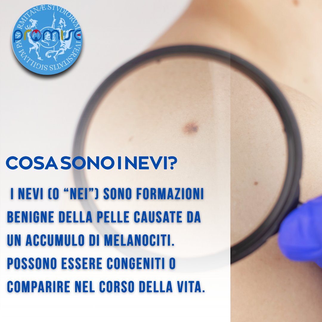 𝐂𝐨𝐬𝐚 𝐬𝐨𝐧𝐨 𝐢 #𝐧𝐞𝐯𝐢? noti come #nei sono piccole lesioni pigmentate sul corpo. Nella maggior parte dei casi sono benigni, ma alcuni possono evolvere nel tempo. Controllarli è fondamentale! #prevenzionecutanea #dermatologia #PROMISEUNIPA #salutedellapelle #ABCDEdeiNevi