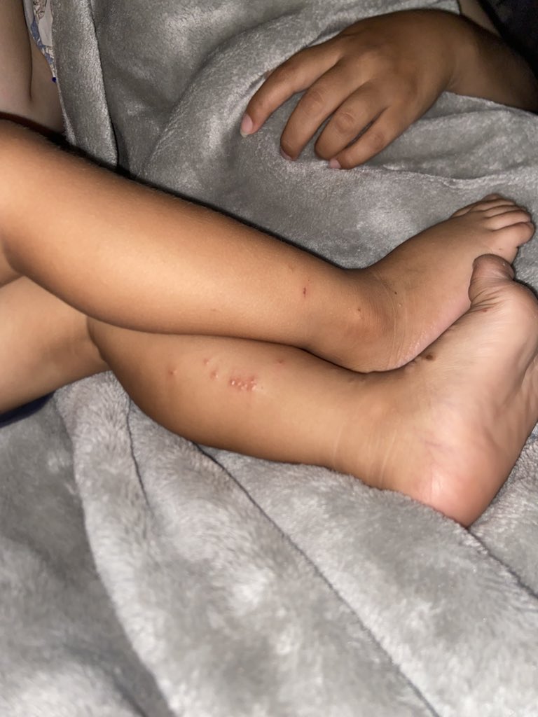 SQadih18061's tweet image. This is my beautiful child, how was he and how did he complain of love in his foot and hurt him? Please help me buy his treatment in the paper.
gofund.me/4622c497
x.com/aechoire?s=11