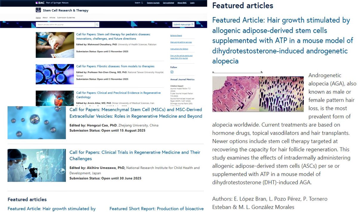 La revista "Sten Cell Research&amp;Therapy" continúa destacando en su portada la investigación liderada por el Dr. Eduardo López Bran enfocada en que tod@s volvamos a tener pelo en el año 2030: ¡Adiós a la calvicie común!

📰 stemcellres.biomedcentral.com

👉 youtube.com/playlist?list=…