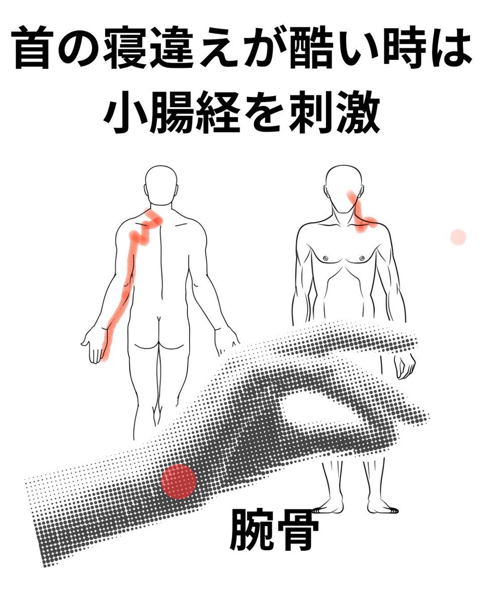 Q-bit光量子チップ（東洋医学におけるツボ（経絡）を刺激） Q-bit光量子チップ（東洋医学におけるツボ（経絡）を刺激）
