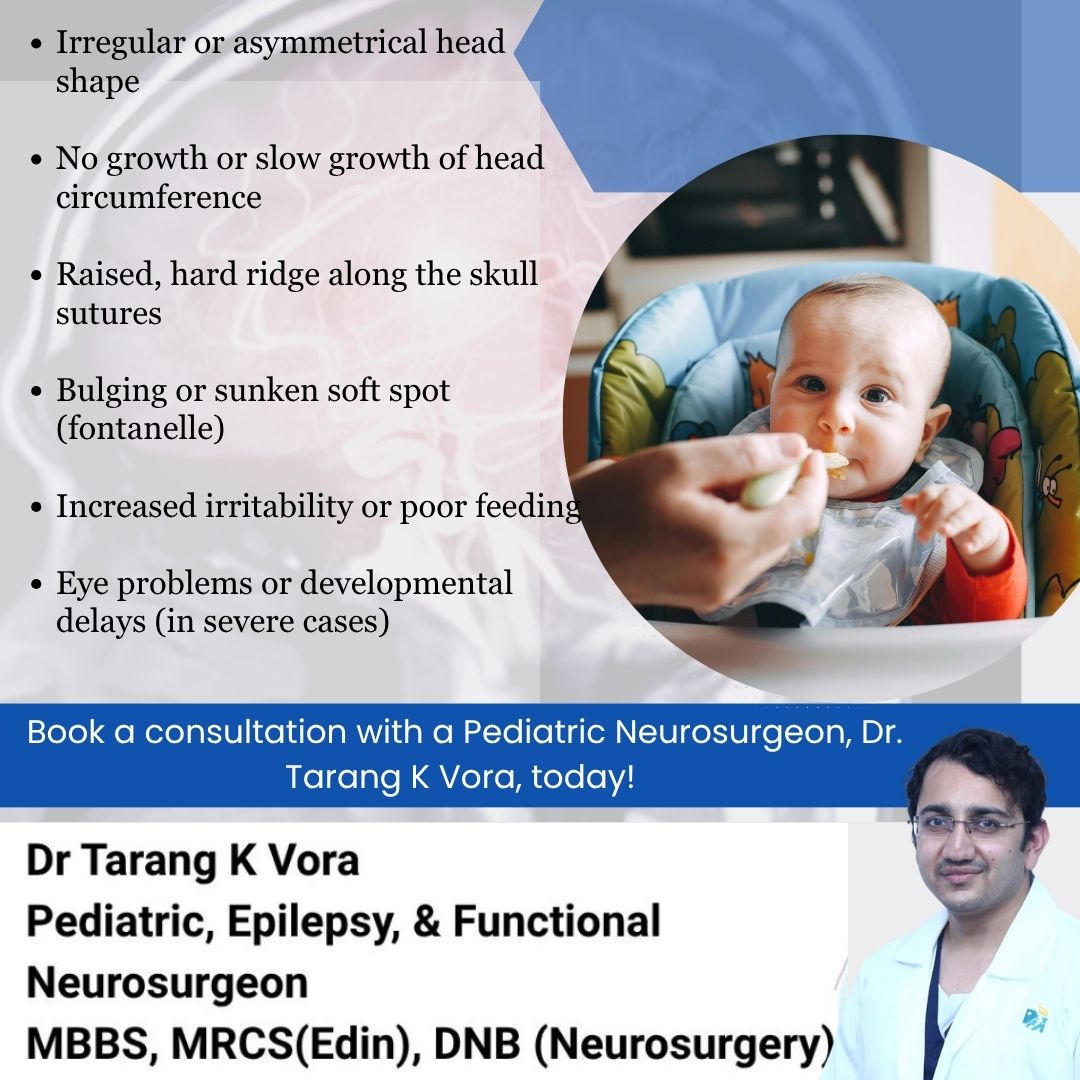 dr_tarangvora's tweet photo. #Craniosynostosis is a condition where skull bones fuse too early, affecting head shape and brain growth.

#childneurosurgeon #flathead #pediatric #childhealth #hyderabad https://t.co/f7eb4qpfto