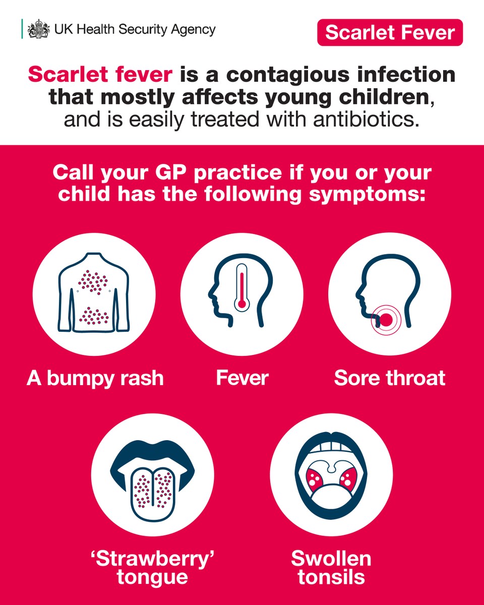 #ScarletFever is common in young children and usually mild, but it’s important to get it treated so it doesn’t become something more serious. If you spot the symptoms below, contact your GP practice. 📱
🔗 nhs.uk/conditions/sca…