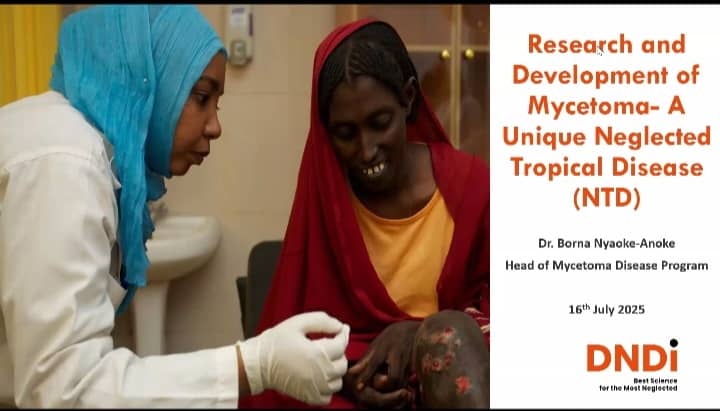 MycetomaRC's tweet image. Incredible regional webinar yesterday! β¨ @WHO_EMRO, @DNDi, & @MycetomaRC united experts to 'Unite, Act, Eliminate' mycetoma (a chronic NTD).
Feat. @ProfAHFahal from @MycetomaRC & Dr @bornanyaoke from @DNDi. Plus key discussions with @WHO experts!
#Mycetoma #NTDs #GlobalHealth