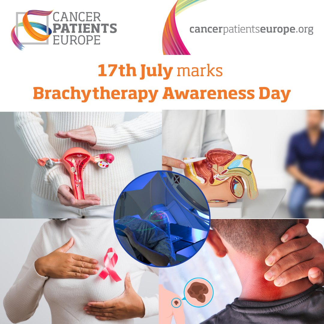 CancerPatientsE's tweet image. 🎯 17 July marks #BrachytherapyAwarenessDay
At CPE, we support greater awareness, access, and research into brachytherapy — so more patients can benefit from its precision and potential.
🔗 Read the GEC-ESTRO Press Release: lnkd.in/d5c5-JCN