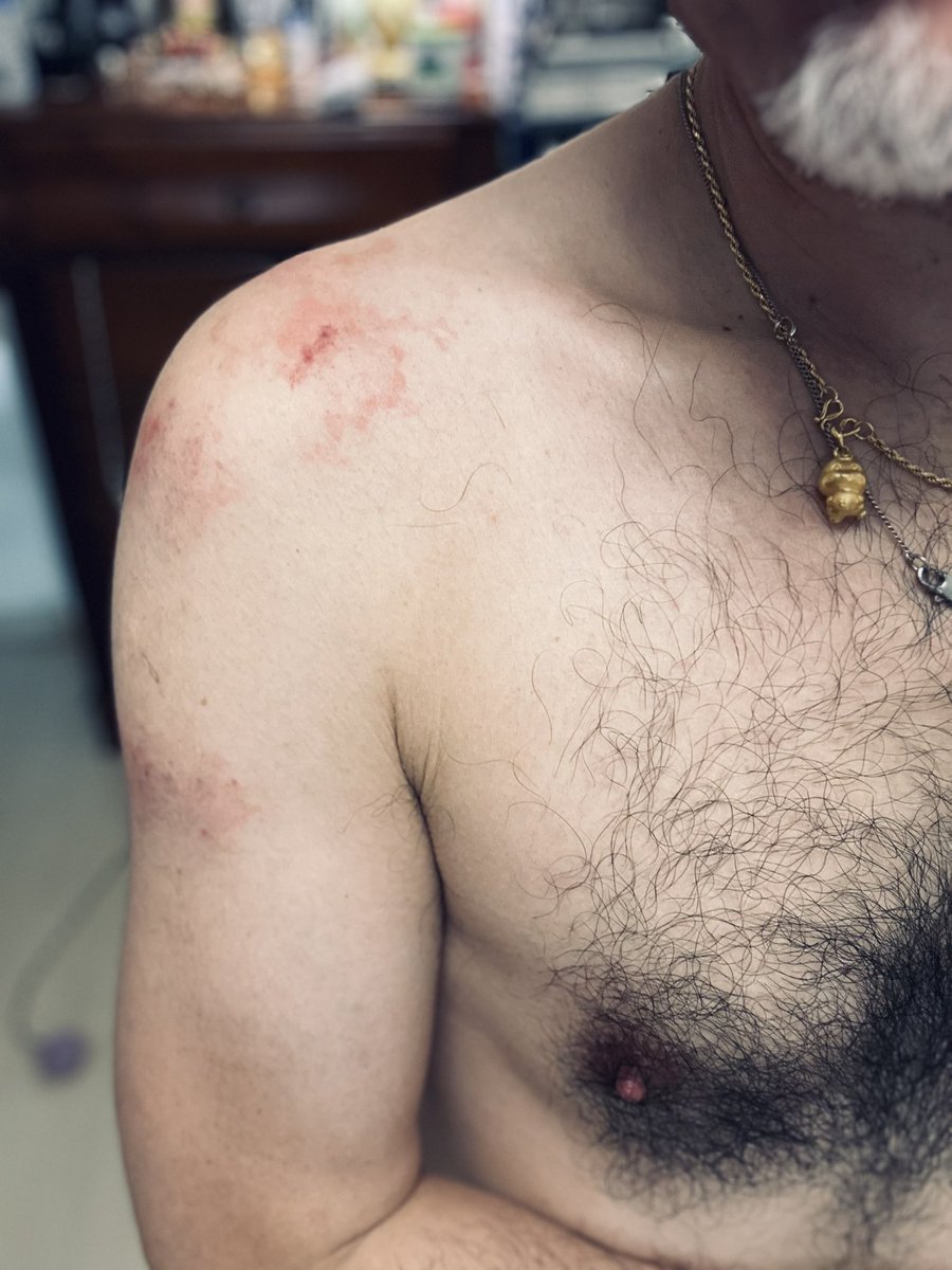 做爱的代价🤣咬的有点狠😅