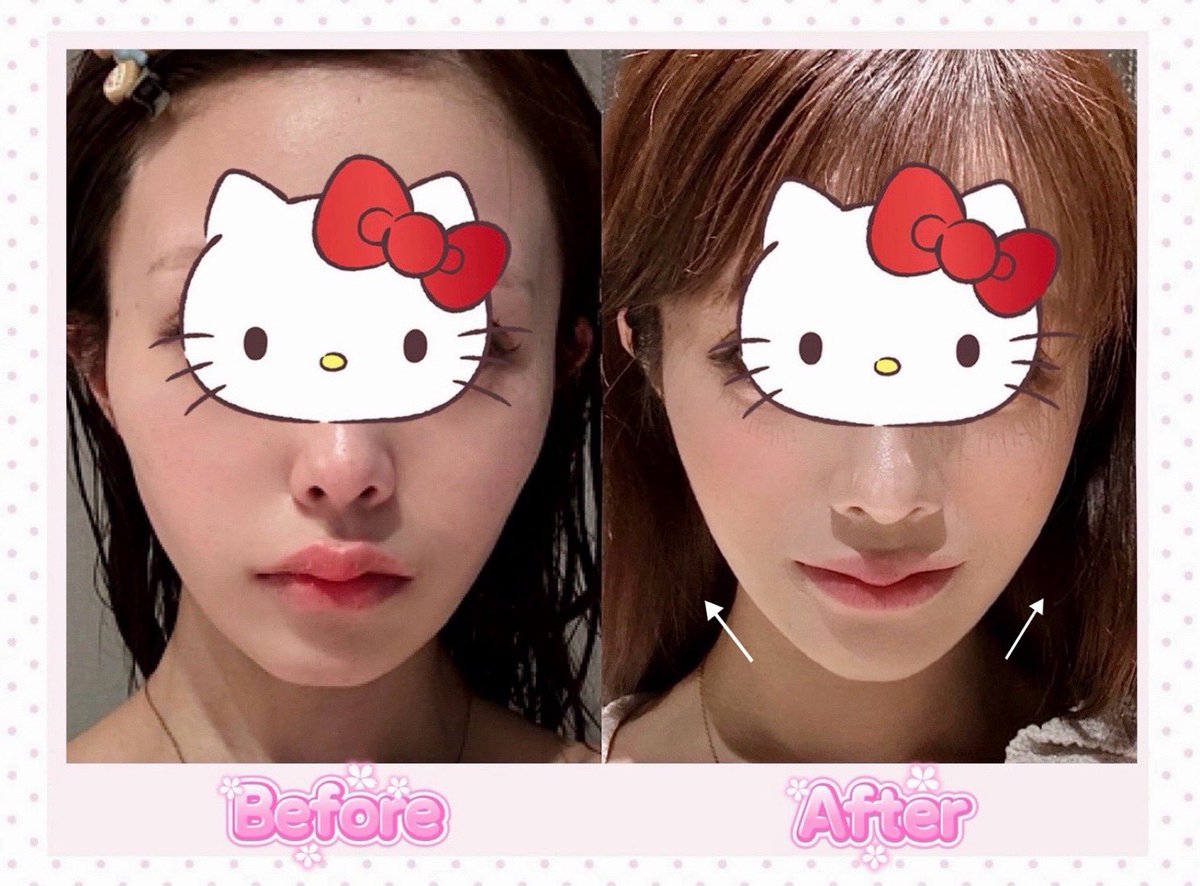 《盛り耐性あり》の顔になりたいなら..？まずはもたつき知らずのちゅるりんフェイスにすること！同じメイクでも印象ガラッと変わる🍑💭✨