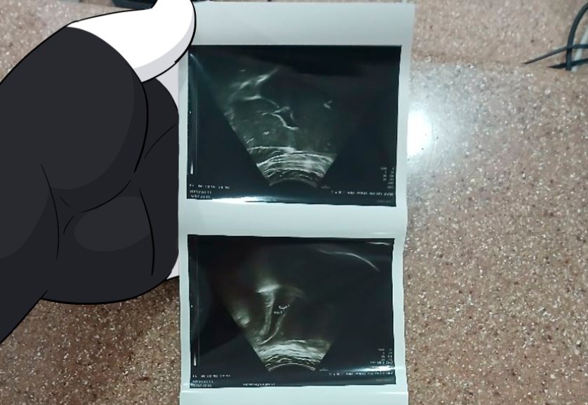 ThePandobo 🍉🍉🍉 tweet media